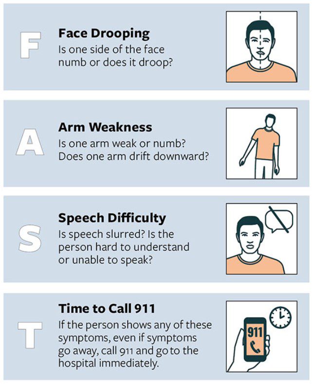 FAST: How to spot a stroke and know when to call 911