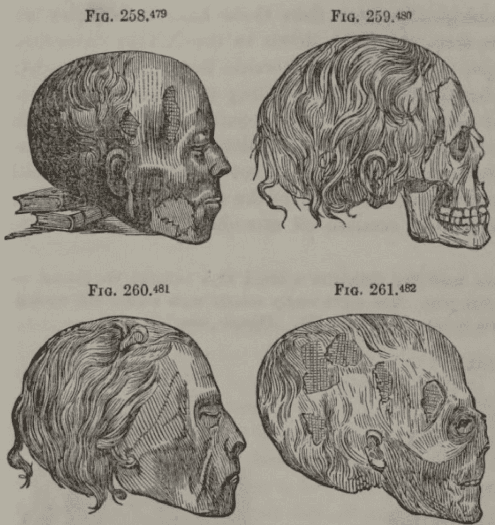 The Conversation | Morton et al/U.S. National Library of Medicine/Internet Archive