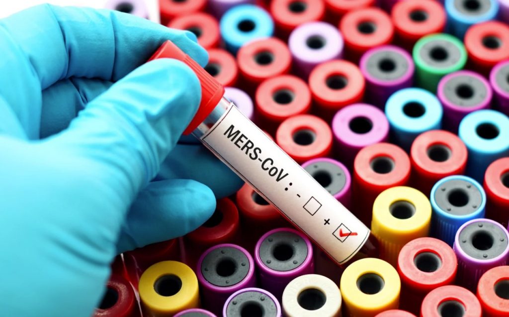 SCI AM | jarun011/Getty